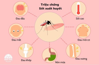 Dấu hiệu của bệnh sốt xuất huyết