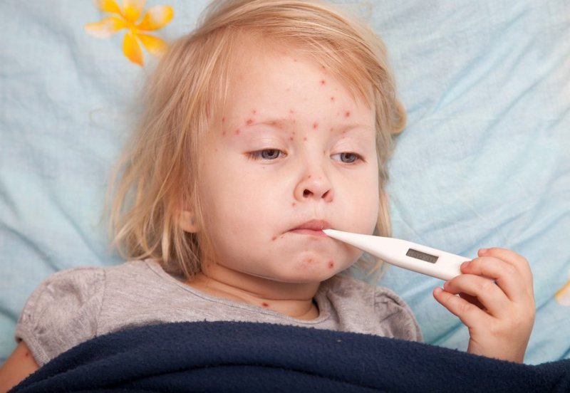 Các dấu hiệu và cách phòng bệnh sốt siêu vi